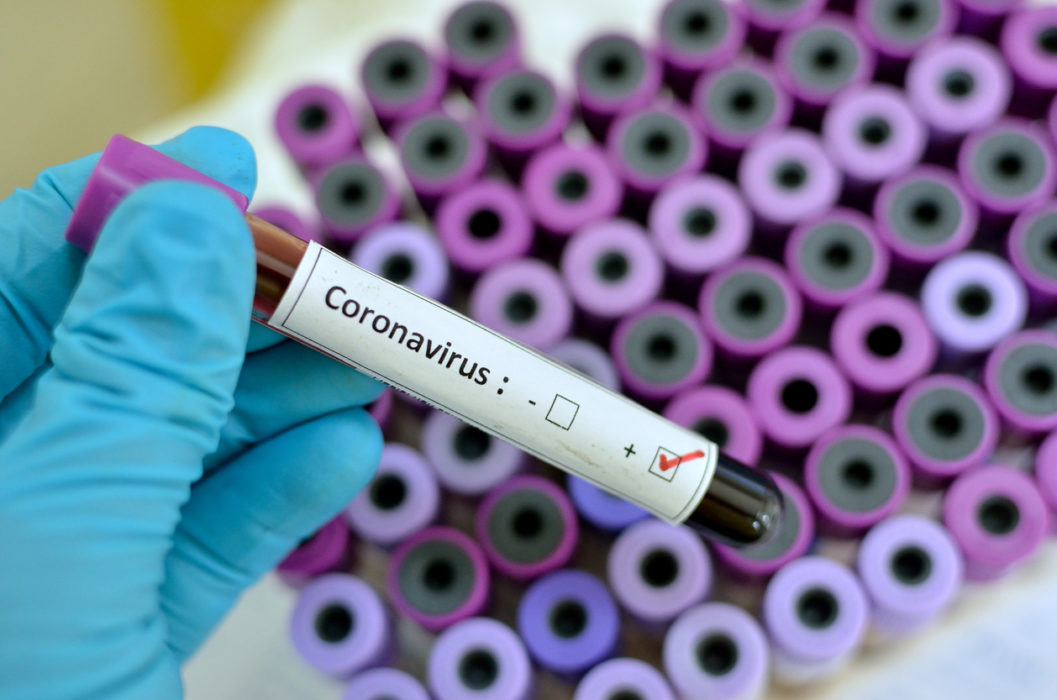 Coronavirus: Is It No Major Worry Or A Pandemic? Yes.